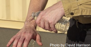 A person applies water to their hands for First aid for skin exposure